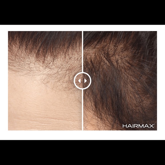 HAIRMAX LASERCOMB ULTIMA 9 HAIR GROWTH LASER LIGHT - Picture 2 of 2